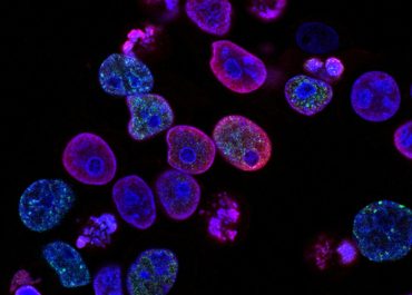 The Ultimate Guide To Stem Cell Therapy