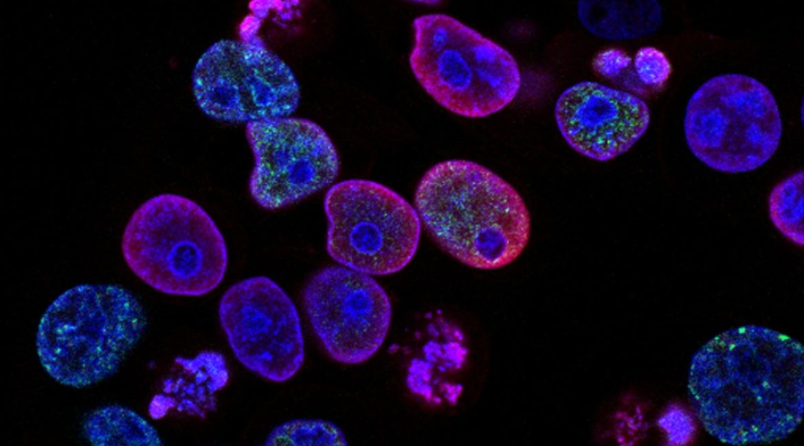 Microscopic view of cells stained in vibrant blue and purple, showing different shapes and sizes under a black background
